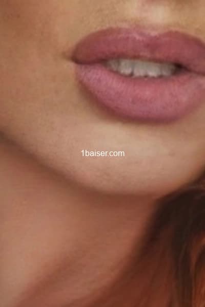 Profile Gallery