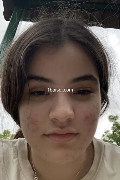 Profile Gallery